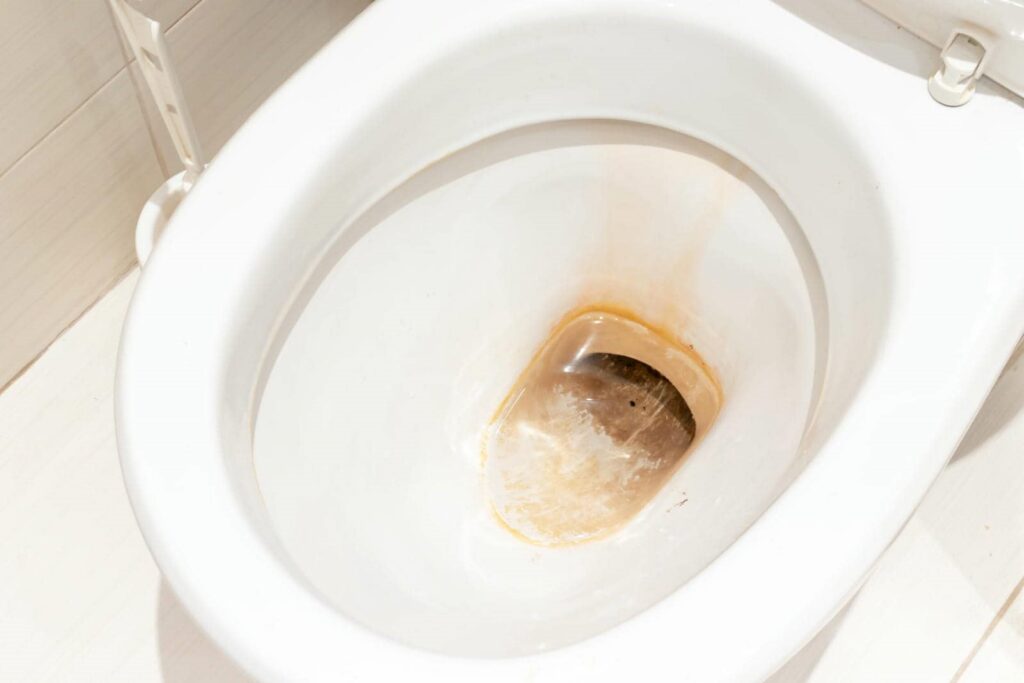 Toilet bowl with visible brown stains and discoloration inside.
